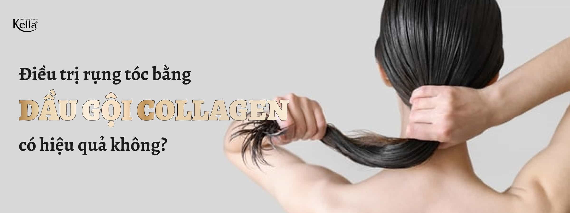 Điều trị rụng tóc bằng dầu gội collagen có hiệu quả không?